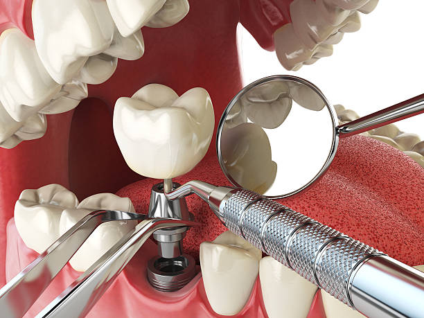Best Emergency Dental Care for Trauma or Injury in Bingham Farms, MI